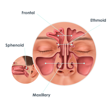 ms-ear-nose-admission