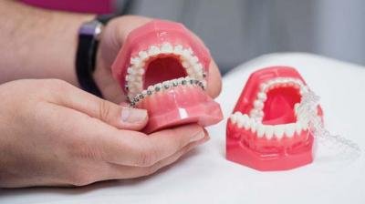 MDS Orthodontics and Dentofacial Orthopaedics