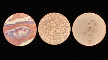 diploma-in-tropical-medicine-and-health-admission